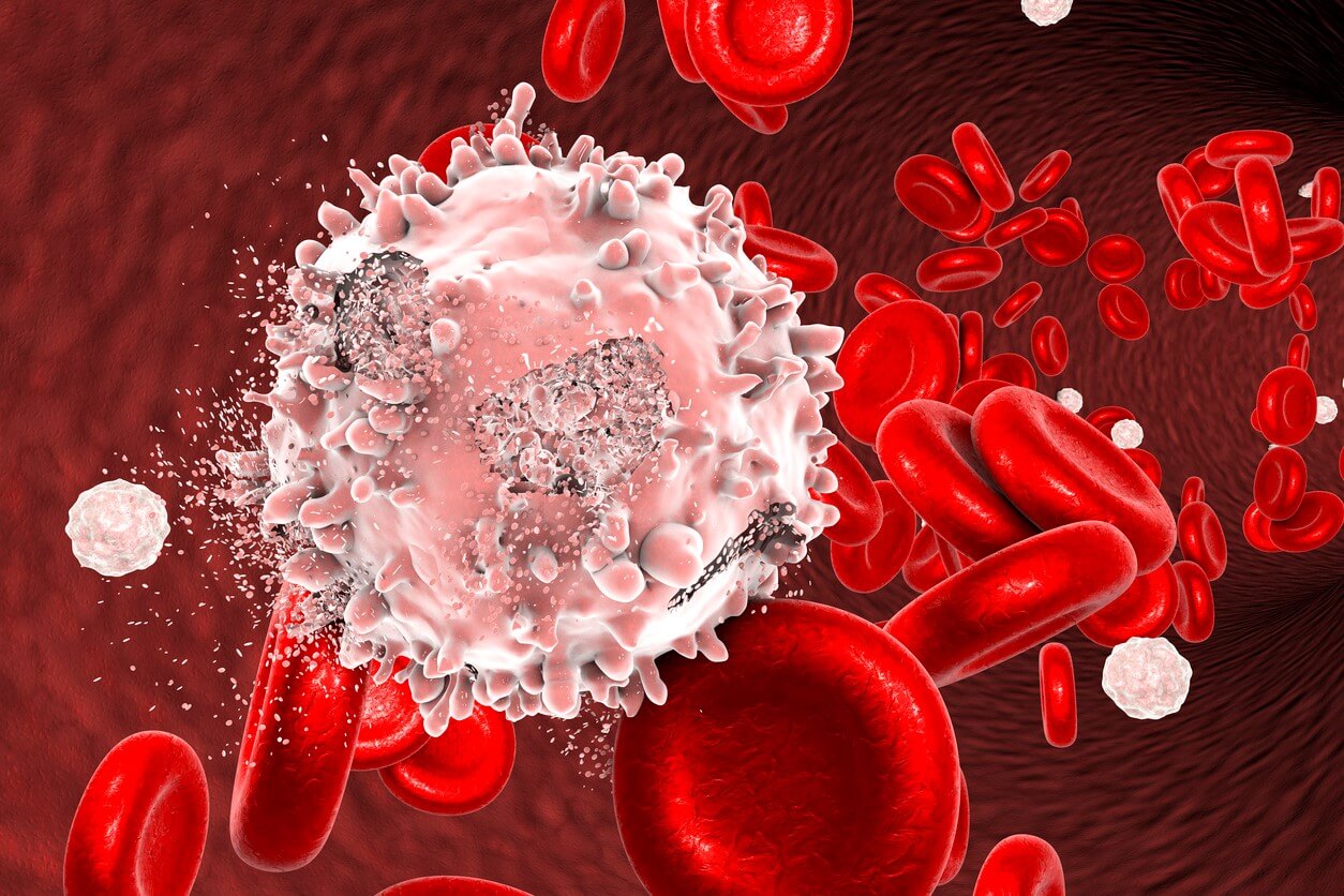 Blood Cancer Treatment in india