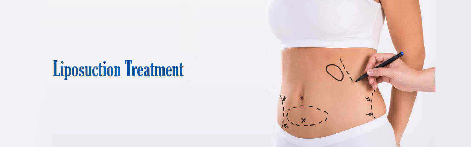Liposuction Treatment in Thailand