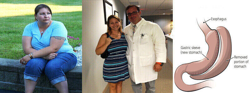 Bariatric Surgery in Las Vegas