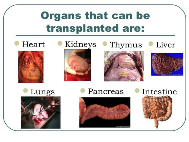 Organ Transplantation In India