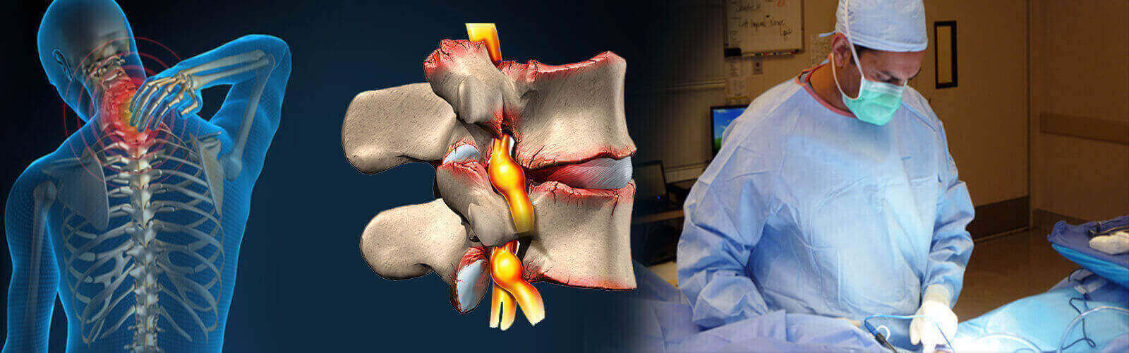 Spinal Stenosis Surgery in Birkenhead