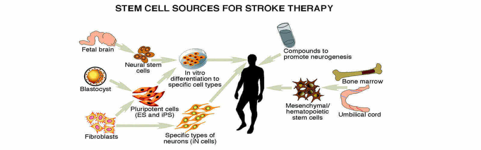 Stem Cell Therapy In India